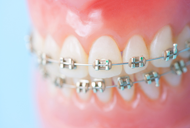 矯正歯科について